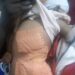 Yaoundé: six month old baby brutally attacked by a monkey in mvog betsi
